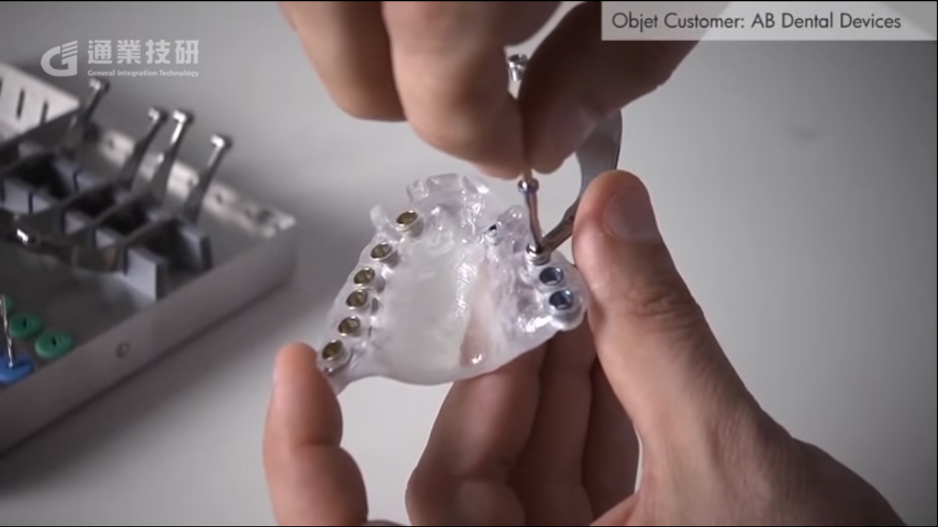 以色列AB Dental使用3D列印製作手術導板