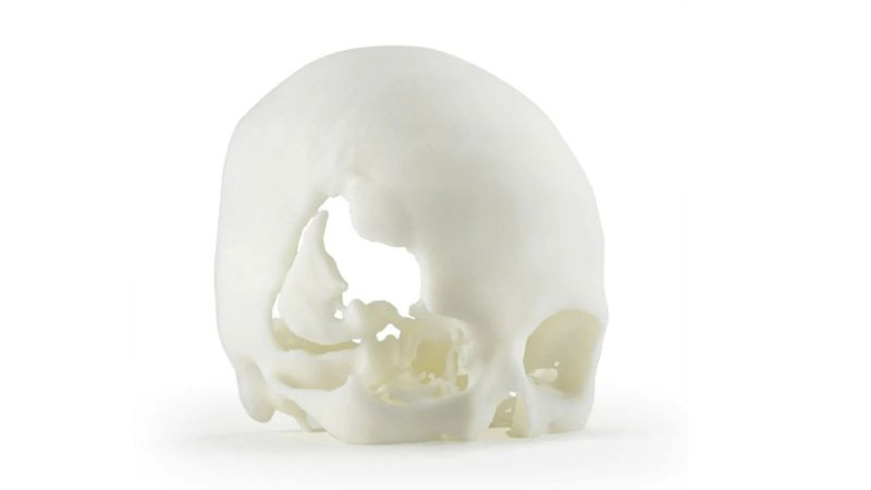 認識ISO 10993認證生物相容性3D列印材料 認識ISO 10993認證生物相容性3D列印材料