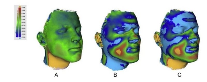 Artec 手持式3D掃描於醫療產業的應用 Artec 手持式3D掃描於醫療產業的應用