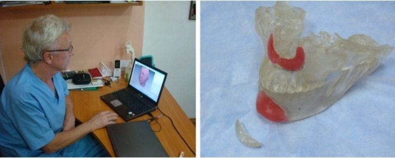 Artec 手持式3D掃描於醫療產業的應用 Artec 手持式3D掃描於醫療產業的應用